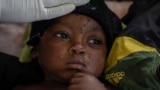 FILE - Emile Miango, 2, who has mpox, lies in a hospital, in Kamituga, South Kivu province, Sept. 4, 2024, in the Democratic Republic of Congo. (AP Photo/Moses Sawasawa, file)