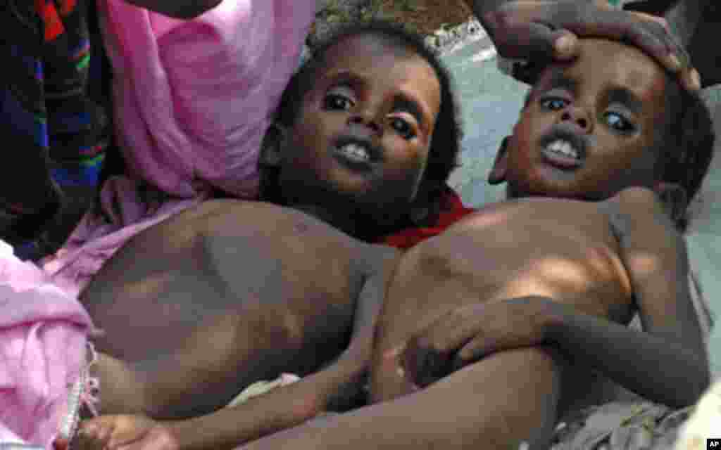 Laba caruur ah oo nafaqo-daro ka muuqato oo ku sugan xero barakacayaal oo ku taalla Muqdisho, July 18, 2011