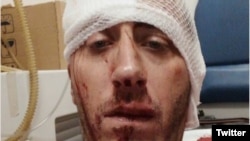 Vladimir Kovačević nakon napada ispred zgrade u kojoj živi