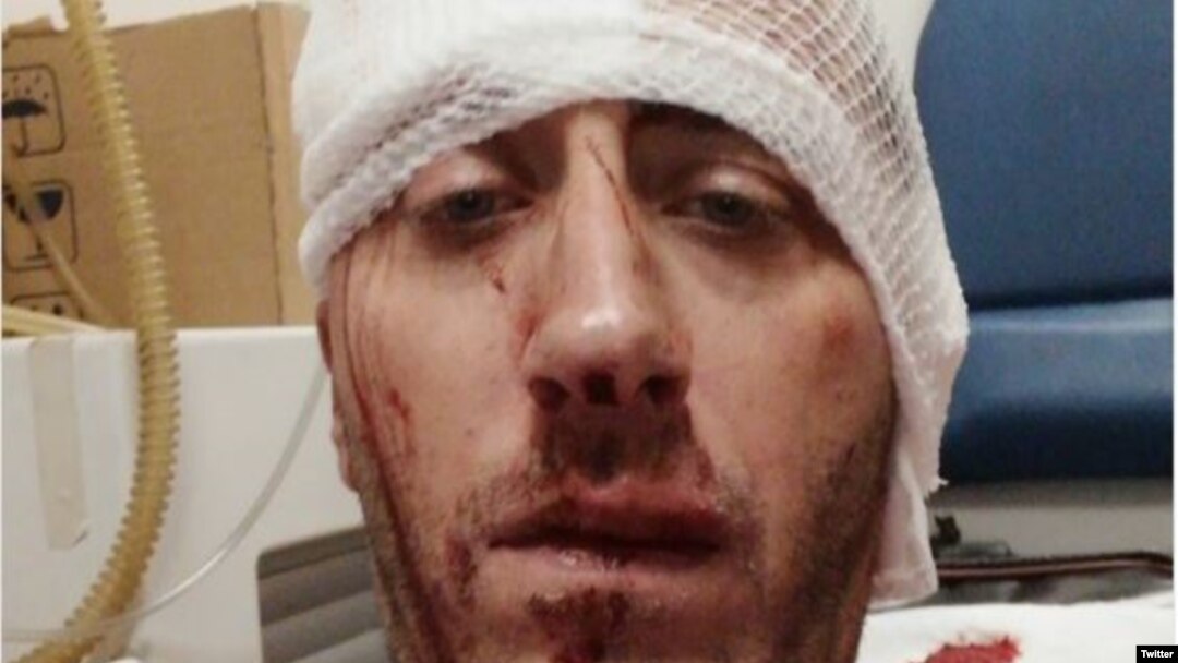 Novinar Vladimir Kovačević je teško pretučen 26. augusta u Banja Luci