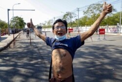 A man with a tattoo of Gen. Aung San, father of detained Myanmar leader Aung San Suu Kyi, gestures stands close to a cordoned-off road with police trucks and water cannons, Feb. 10, 2021.