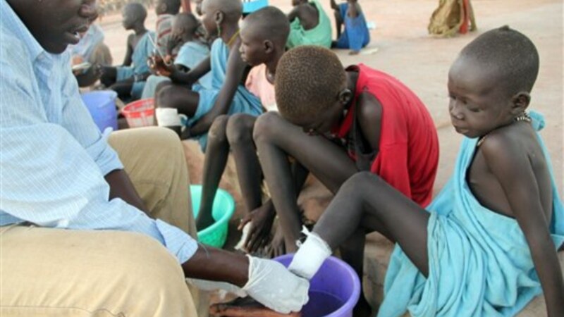 Guinea Worm Disease Could Soon be Wiped Out, Experts Say