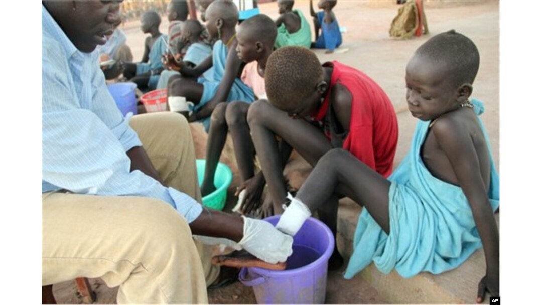 FILE - Ajak Kuol Nyamchiek watches while John Lotiki, a nurse with the Carter Center, bandages blisters on her leg from where a Guinea worm is emerging, Abuyong, Sudan, Nov. 4, 2010.