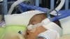 Numbers of Premature Births Rising