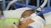 Numbers of Premature Births Rising