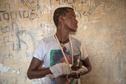 Abrahaley Minasbo, a 22-year-old trained dancer and Tigrayan survivor from Mai-Kadra, Ethiopia, shows wounds on his face and his partially amputated hand, in Hamdayat Transition Center near the Sudan-Ethiopia border, eastern Sudan, Dec. 15, 2020.