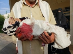 FILE - A man carries his injured daughter after Houthi missile attack, in Marib, Yemen, Oct. 3, 2021.