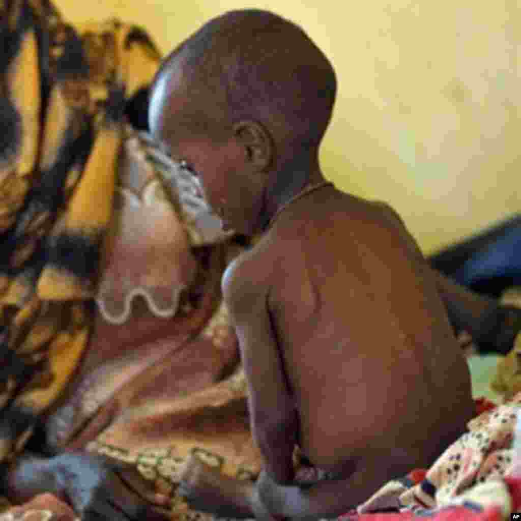 Wiil yar oo nafaqo-darro hayso oo ku fadhiya dhabta hooyadii, waxay ku sugan yihiin cisbitaal Medecins sans Frontieres ay ku leeyihiin Ceel Wak,Kenya,