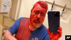 Dmitri Muratov, dobitnik Nobelove nagrade i ruski novinar, pravi telefonom selfi nakon što je napadnut i nakon što je poliven crvenom bojom u vozu. Fotografija je objavljena na Telegram profilu Nove gazete, 7. aprila 2022.