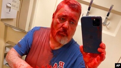 Russian Nobel Laureate Muratov Doused With Red Paint by