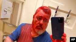 드미트리 무라토프 '노바야 가제타' 편집장이 7일 붉은 페인트 혼합 물질에 공격당했다며 이 신문 유럽판이 이날 텔레그램에 게시한 사진.