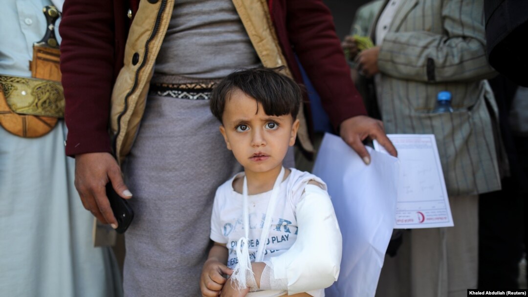 Seorang anak laki-laki tampak menatap kamera ketika ia berjalan keluar sehabis menjalani perawatan dari klinik patah tulang di daerah Sanaa, Yaman, pada 14 Oktober 2021. (Foto: Reuters/Khaled Abdullah)