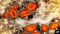 This image provided by the National Institute of Allergy and Infectious Diseases (NIAID) shows a colorized transmission electron micrograph of monkeypox particles (orange) found within an infected cell (brown), cultured in the laboratory. (NIAID via AP)