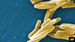 U Istočnoj Europi, svakog sata 7 osoba umre od tuberkuloze