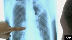 Studime të reja për pesticidet organofosfate, shtatgjatësinë dhe kujtesën
