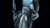 First Images of Giant Squid Filmed in Ocean