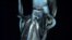 A giant squid is seen in this still image taken from video captured from a submersible by a Japanese-led team of scientists near Ogasawara islands , in this handout picture released by NHK/NEP/Discovery Channel in Tokyo, Japan, January 7.