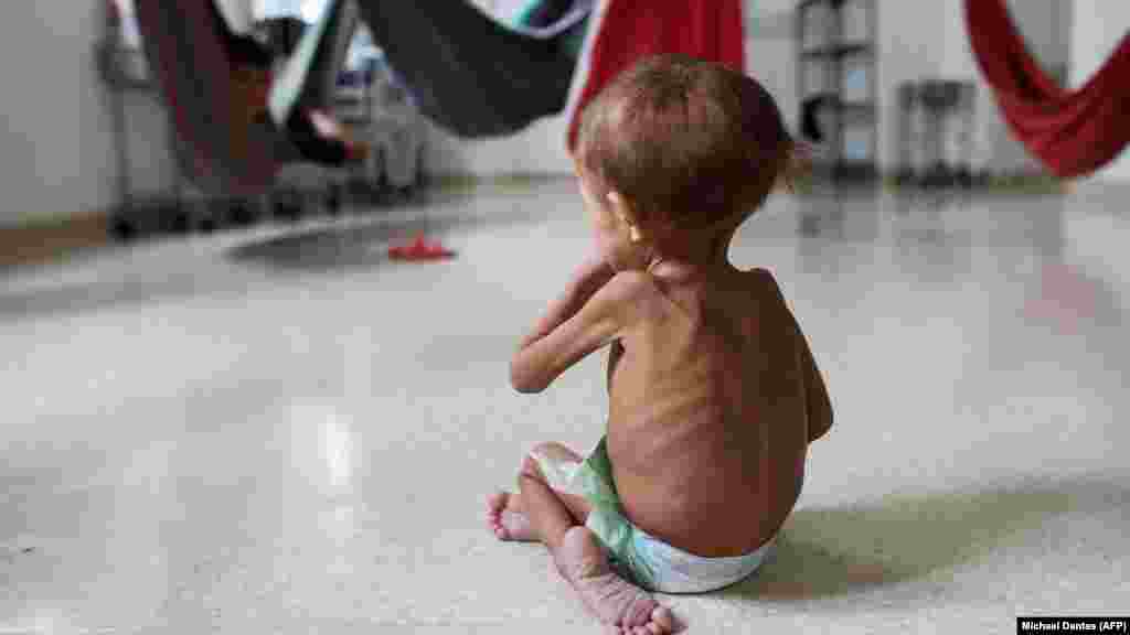 Un bebé Yanomami con desnutrición severa recibe cuidados en una sala del hospital infantil San Antonio, en Boa Vista, estado brasileño de Roraima, el 27 de enero de 2023. El gobierno de Lula da Silva decretó el estado de emergencia sanitario para acelerar la ayuda federal a la comunidad indígena.