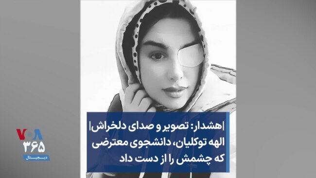 هشدار: تصویر و صدای دلخراش| الهه توکلیان، دانشجوی معترضی که چشمش را از دست داد