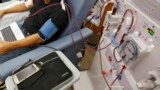 FILE - A patient undergoes kidney dialysis at a clinic in Sacramento, Calif., on Sept. 24, 2018.