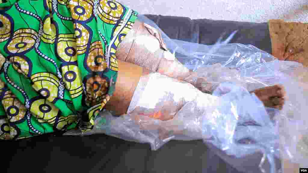 Mmoja wa majeruhi wa shambulizi la kigaidi lililotokea katika kanisa moja mjini Kasindi, wilaya ya Beni, DRC.