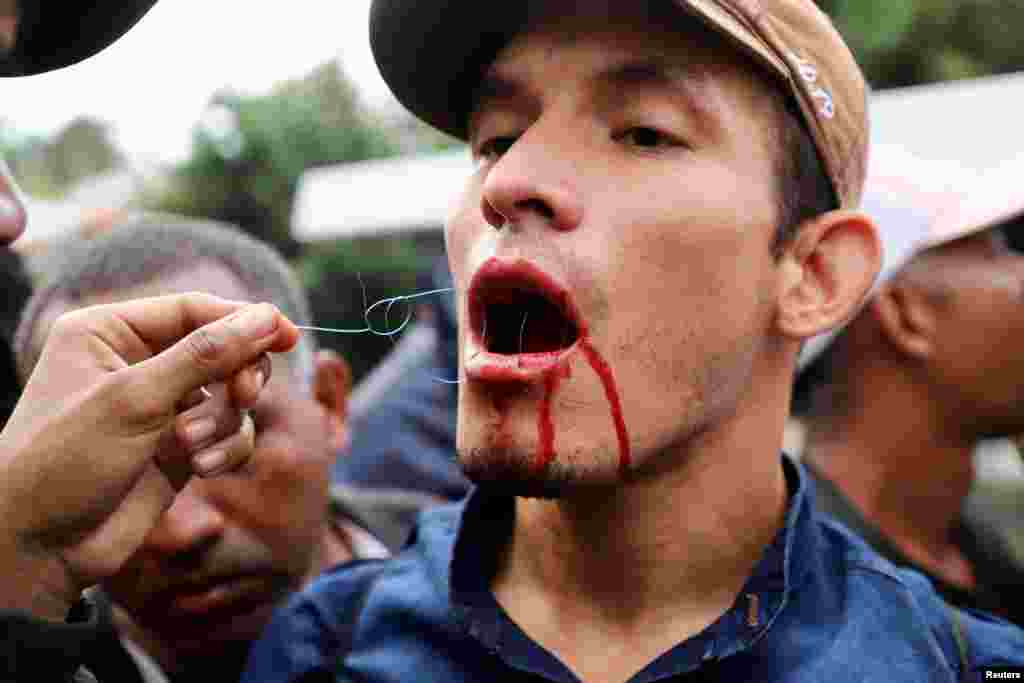 A migrant gets his mouth sewed shut during a protest to demand free transit through the country outside a military facility where Mexican President Andres Manuel Lopez Obrador holds his regular news conference, in Tapachula, Mexico.
