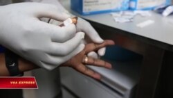 Kenya triển khai xét nghiệm nhanh bệnh sốt rét và COVID 