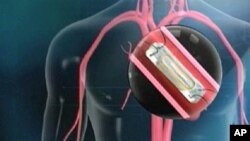 The device is a tiny sensor, implanted through a catheter in the heart's pulmonary artery. The procedure takes just seven minutes. The patient passes a wand over his chest, collecting data on heart pressure. That data is sent electronically to the doctor'