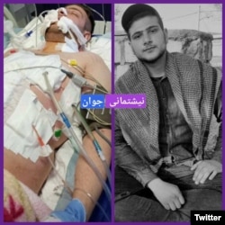 دو عکس از رضا کاظمی، شانزده ساله. او شش روز در شرایط وخیم بستری بود.