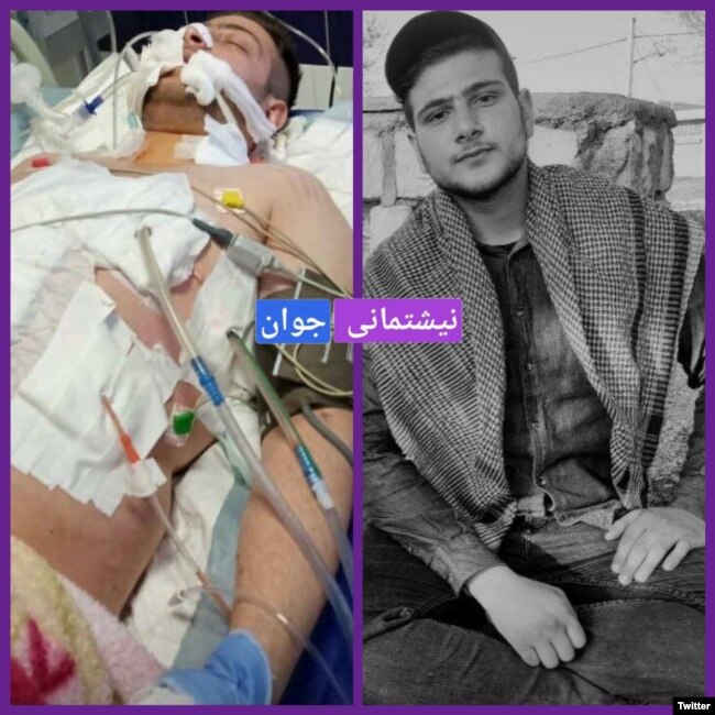 دو عکس از رضا کاظمی، شانزده ساله. او شش روز در شرایط وخیم بستری بود.