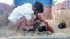 Na fotografiji snimljenoj 17. septembra 2022. vidi se dete, žrtva vazdušnog udara na školu u severozapadnoj oblasti Sagaing, u Mjanmaru, dan posle napada mjanmarskog vojnog helikoptera
