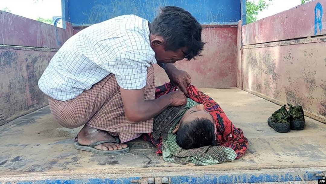 This photo taken on Sept. 17, 2022 shows a young victim of an air strike on a school building in Depeyin township in Myanmar's northwest Sagaing region, a day after an attack on the village by a Myanmar military helicopter.