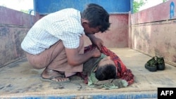 This photo taken on Sept. 17, 2022 shows a young victim of an air strike on a school building in Depeyin township in Myanmar's northwest Sagaing region, a day after an attack on the village by a Myanmar military helicopter.