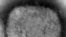 FILE - This 2003 electron microscope image made available by the US Centers for Disease Control and Prevention shows a monkeypox virion.