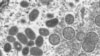 Una imagen microscópica electrónica (EM) muestra partículas maduras del virus de la viruela del mono de forma ovalada