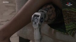 Նիգերիացի կինը վերամշակում է պրոթեզներ, որպեսզի օգնի անդամահատված երեխաներին նորից քայլել_1.mp4