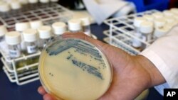 Sebuah cawan petri yang berisi jaringan MSRA, superbug yang tahan terhadap antibiotik, di Rumah Sakit Queen Elizabeth Hospital di King's Lynn, Inggris, pada 12 Oktober 2009. (Foto: AP/Kirsty Wigglesworth)