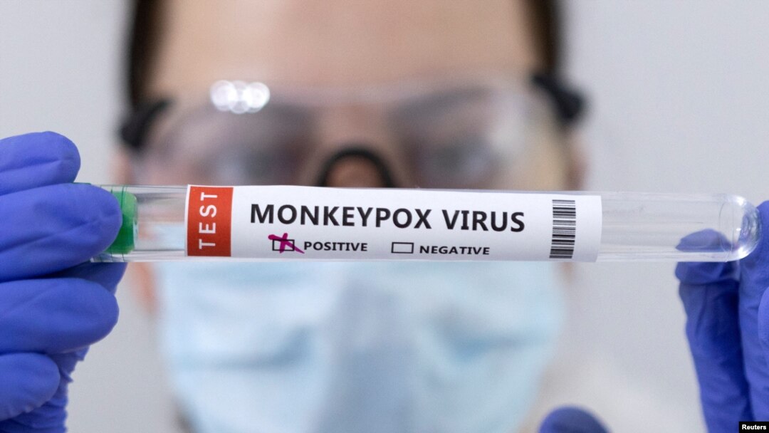 Ilustrasi - Tabung reaksi berlabel "Monkeypox virus positive" 23 Mei 2022. (REUTERS/Dado Ruvic/Illustration/File Photo)