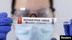 (Ilustrasi) Tabung tes yang diberi label "virus cacar monyet positif"