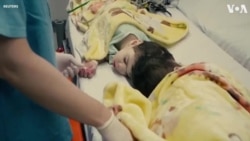 Brazilian Doctors Separate 3-Year-Old Conjoined Twins 