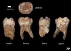 These molars were found in Qesem Cave.