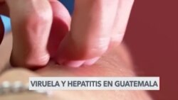 La viruela del mono y la hepatitis ganan terreno en Guatemala