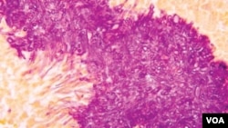 Los CDC clasifica este patógeno causante de la histoplamosis causada por las esporas del hongo capsulatum que “prospera en suelos húmedos ricos en materia orgánica en especial cargados de excrementos de pájaros y murciélagos”. Si bien el paciente puede recuperarse de la fiebre, tos y decaimiento por sí mismo, en algunos casos la infección se puede prolongar a un cuadro severo. (Ilustración cortesía CDC/Dr. Libero Ajello)