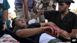 Libyan revolutionary fighters transport an injured man to a field hospital outside Sirte, Libya, September 30, 2011.