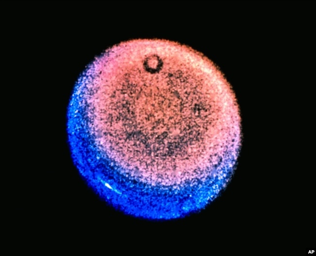 In this image provided by NASA, this false-color Voyager picture of Uranus shows a discrete cloud seen a bright streak near the planet's limb. (AP Photo/NASA)