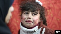 Hala, 9 ans, traitée dans un hôpital de fortune à Saqba, après des bombardements dans la Ghouta orientale, le 22 février 2018.