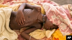FILE - A severely malnourished child lies on the bed at MSF hospital Bentiu, South Sudan, July 3, 2014.