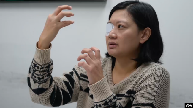 遭遇港警暴力,右眼失明的印尼女记者维比·英达(Veby Mega Indah)(美国之音郁岗拍摄)