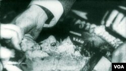 Tortun "Bakı" parçası Adolf Hitlerə təqdim olunur