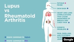 Me kuka sani game da cuter Lupus, ga ra’ayoyin wasu ‘yan Najeriya a Maiduguri akan cutar Lupus da yanayinta.